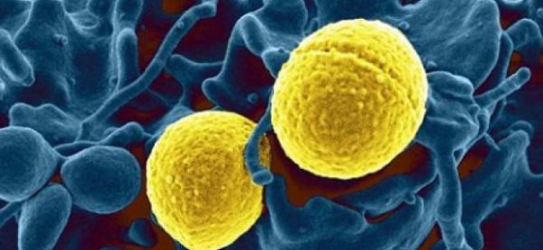Bacteria mortală care bagă în sperieţi Europa! O poţi lua din autobuz sau tren şi îţi roade carnea